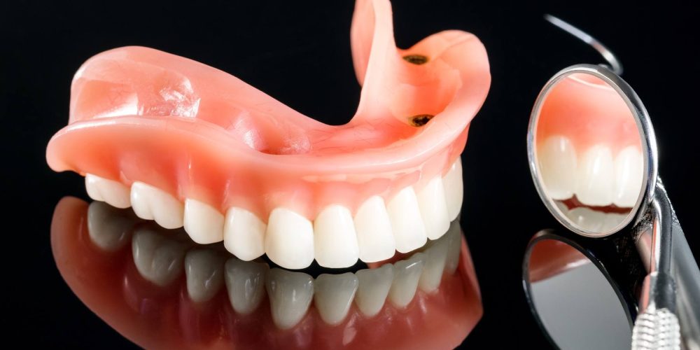 Dental Implant Restoration Registry