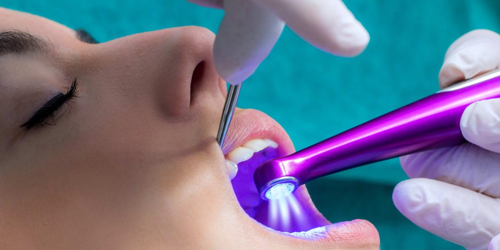 Dental Sealants Quick Poll Results