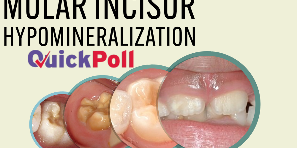 Molar Incisor Hypomineralization Quick Poll Results