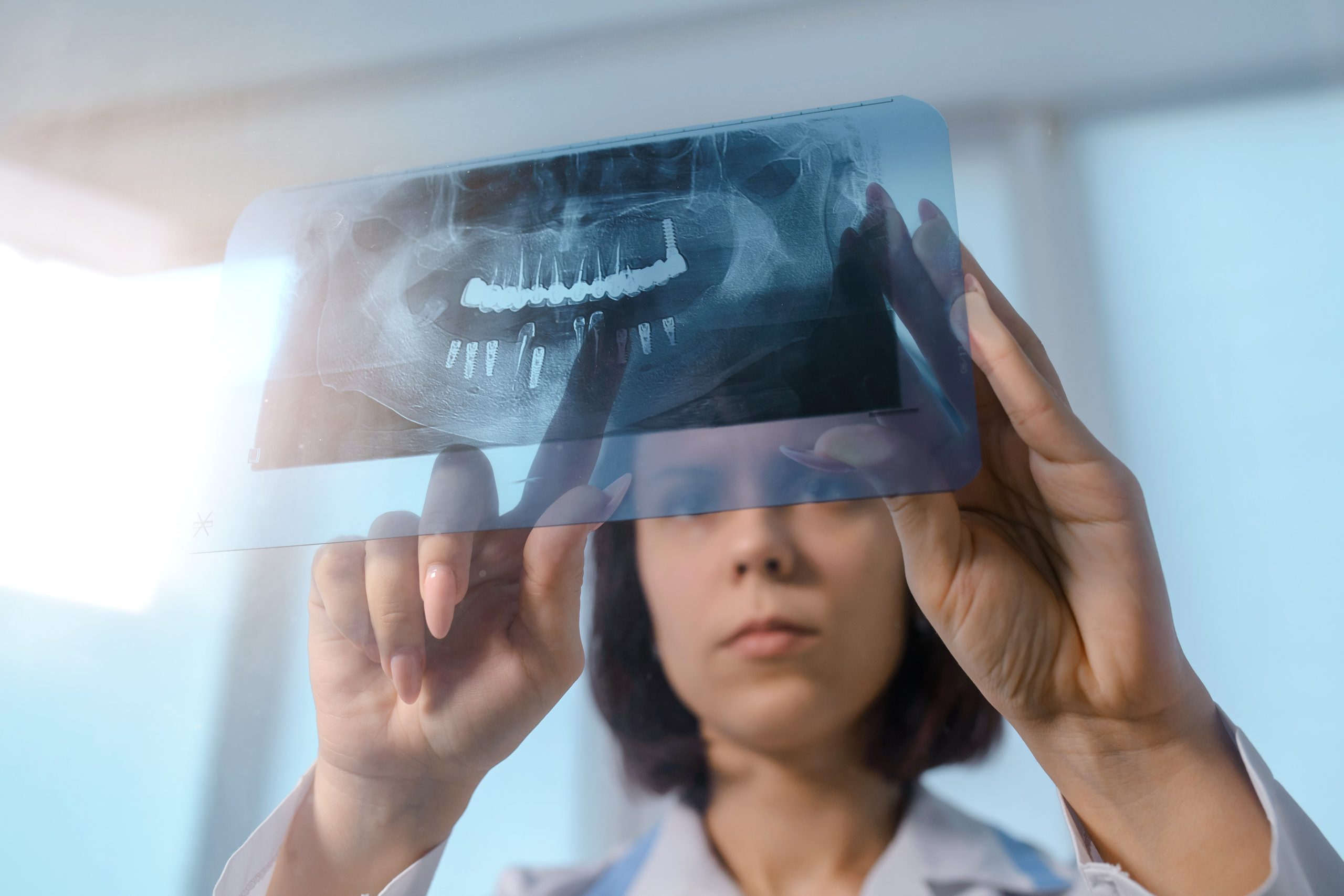A woman looking at an X-Ray for a client's teeth